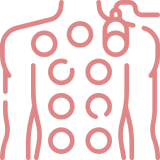 Cupping Therapy